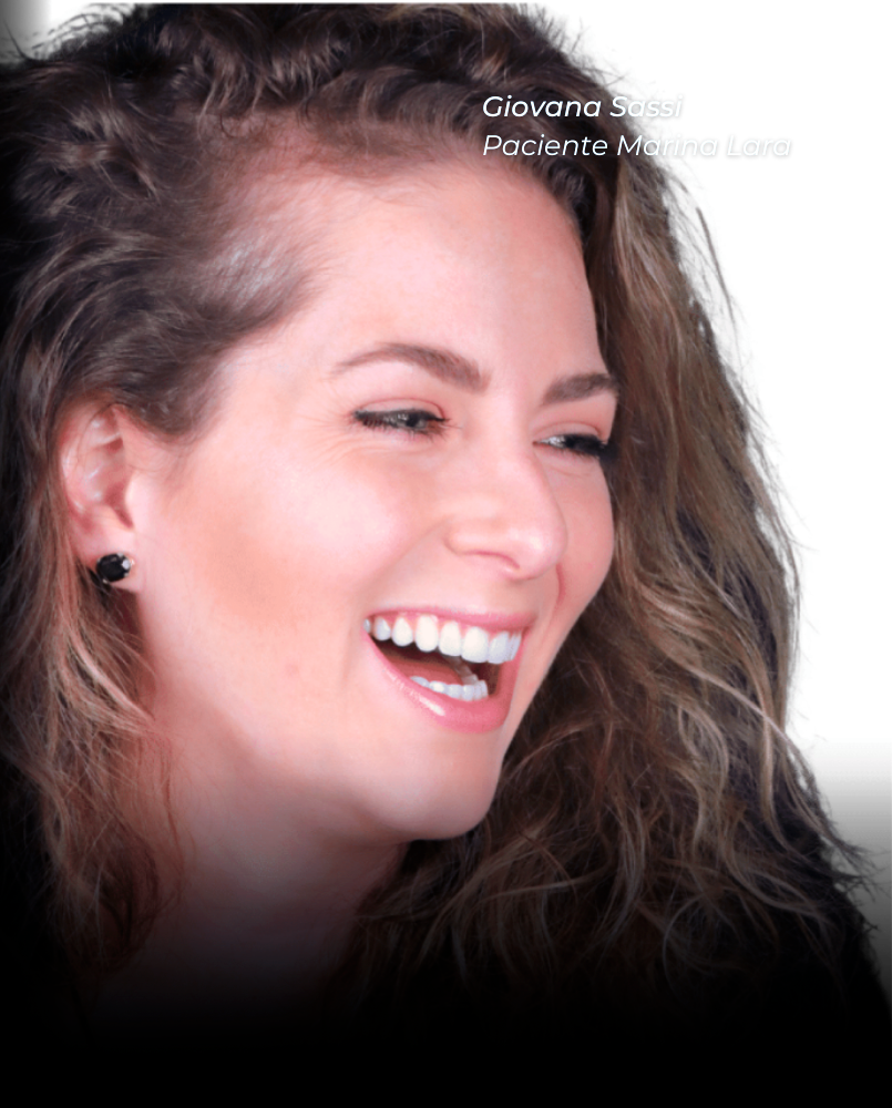 lentes-de-contato-dentais-dr-marina-lara-04
